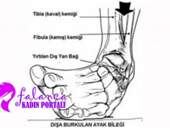Burkulma Nasıl Geçer? Tedavisi