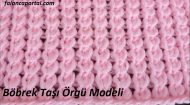 Böbrek Taşı Örgü Modeli