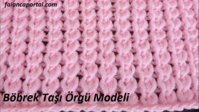 Böbrek Taşı Örgü Modeli