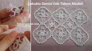 Çubukta Dantel Oda Takımı Modeli