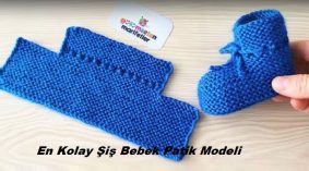En Kolay Şiş Bebek Patik Modeli