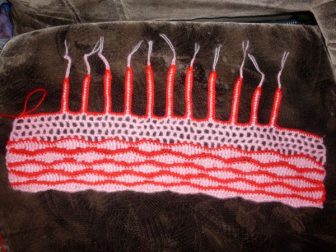 ilginc sac bandaji 3